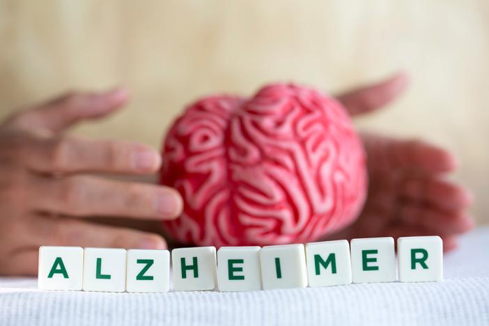 Alzheimer